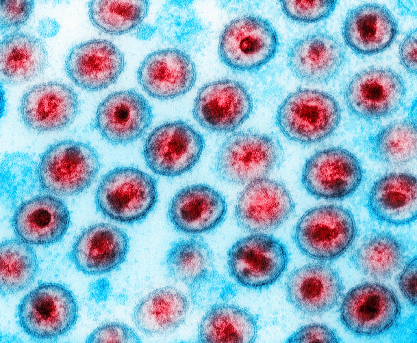 J&J HIV vaccine