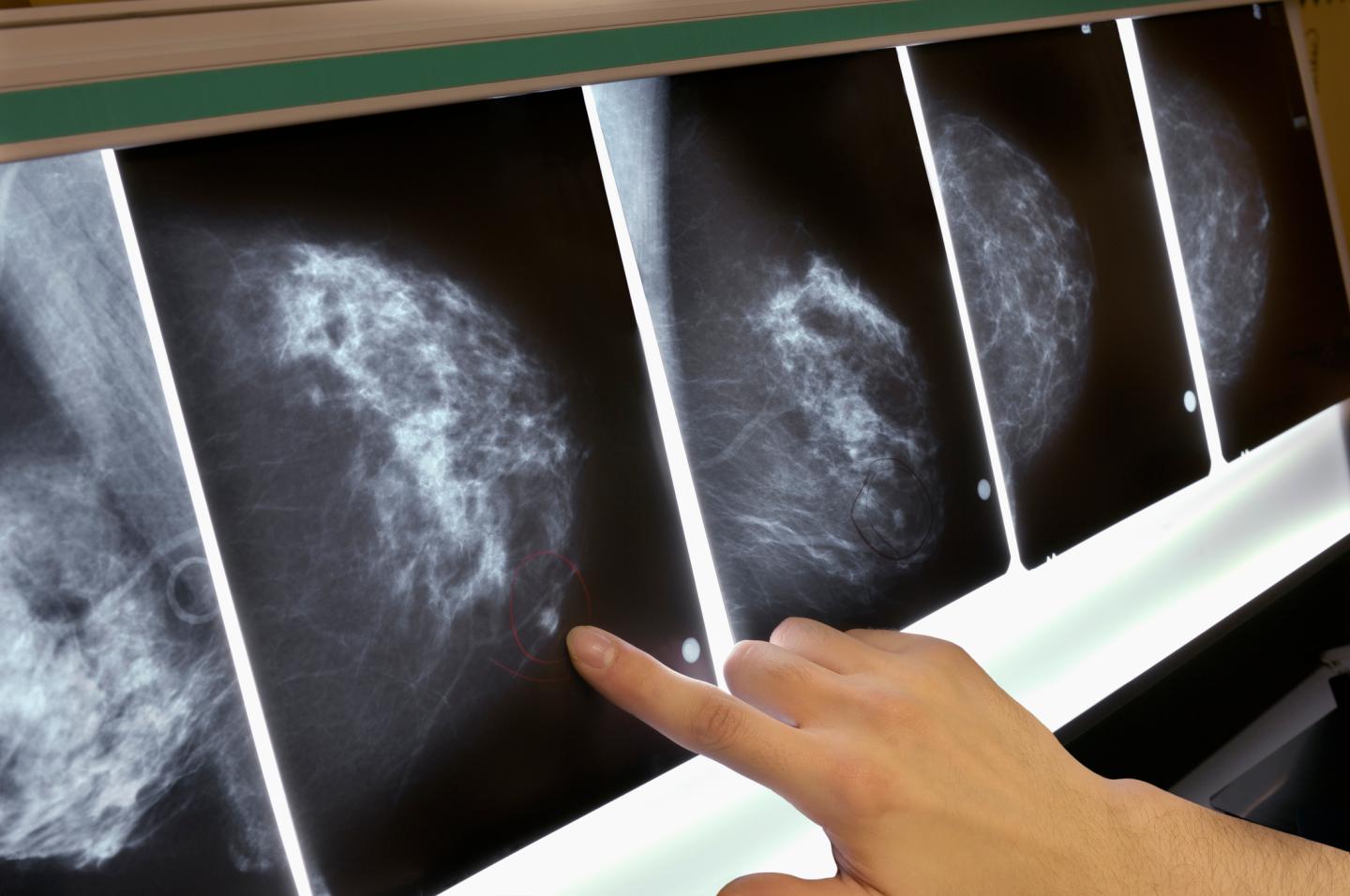BRCA Gene Breast Cancer Testing USPSTF