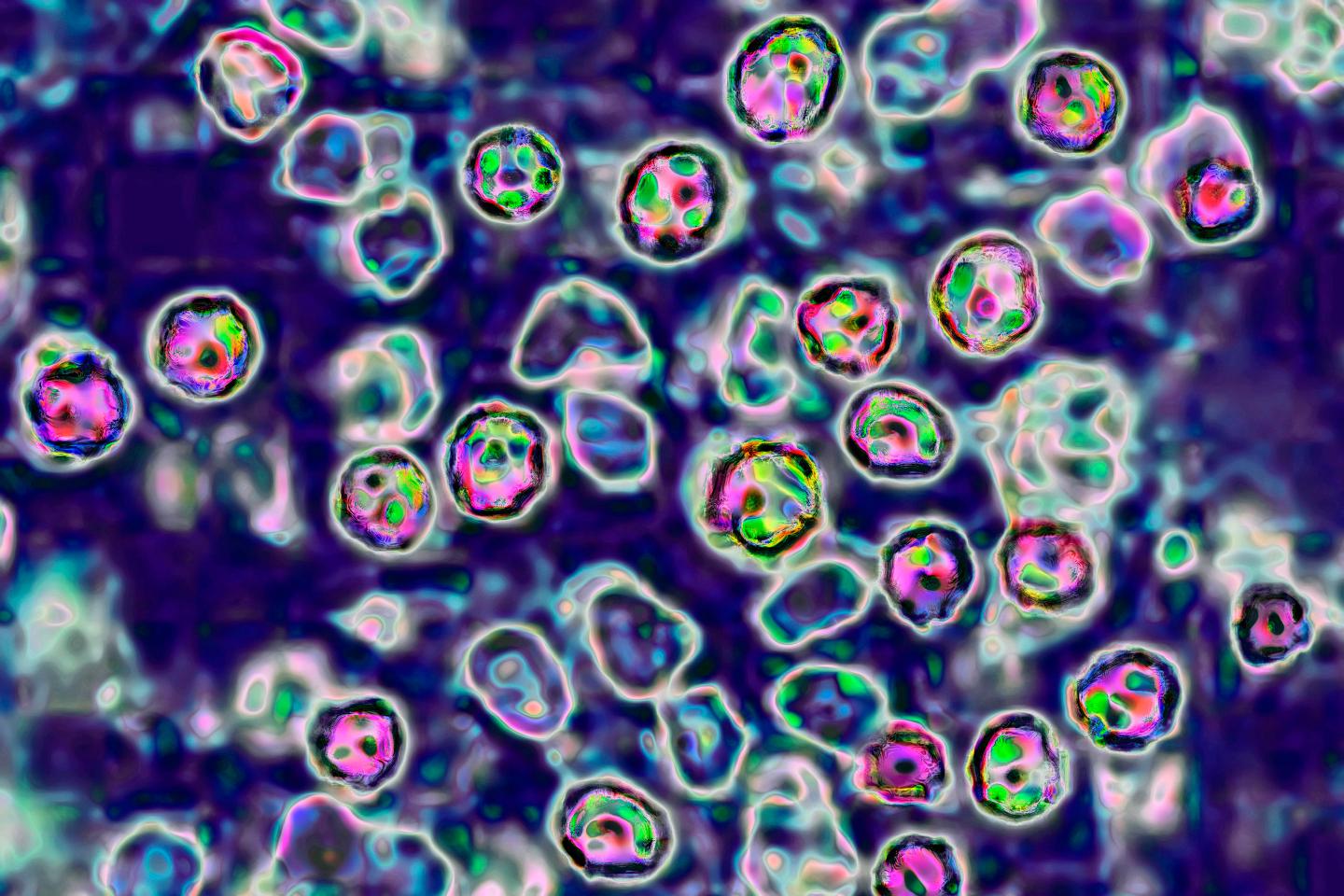 Measles Virus Vaccines