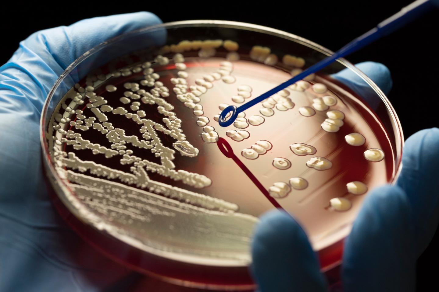 Superbugs Infecting Millions CDC