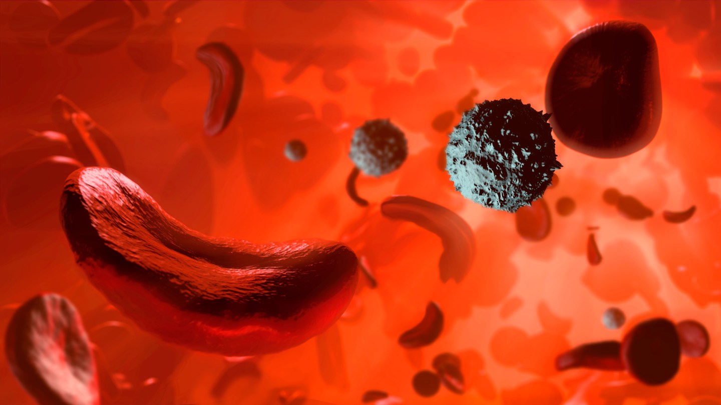 Vertex CRISPR Sickle Cell Blood Disorders