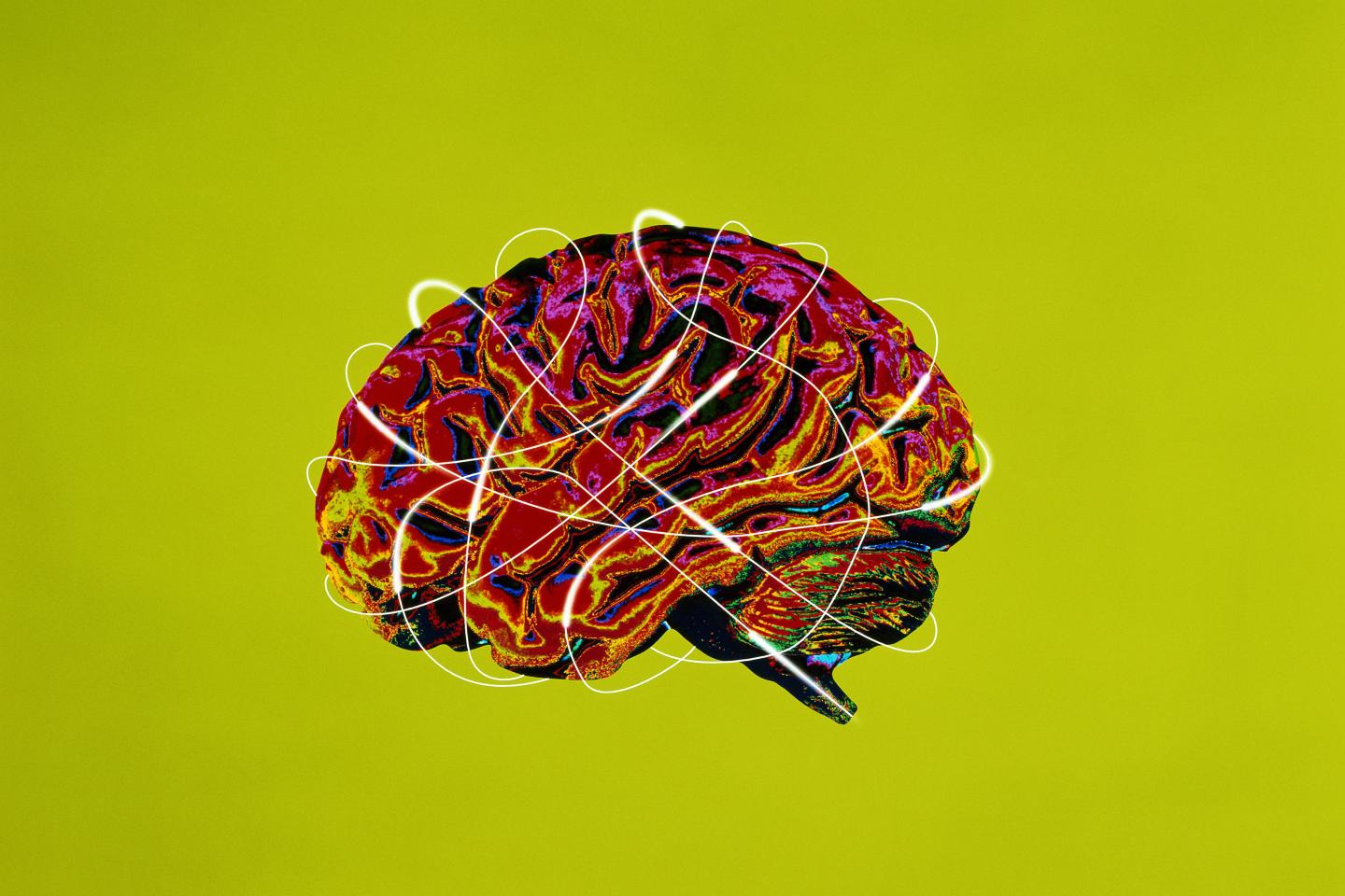 brain-ai