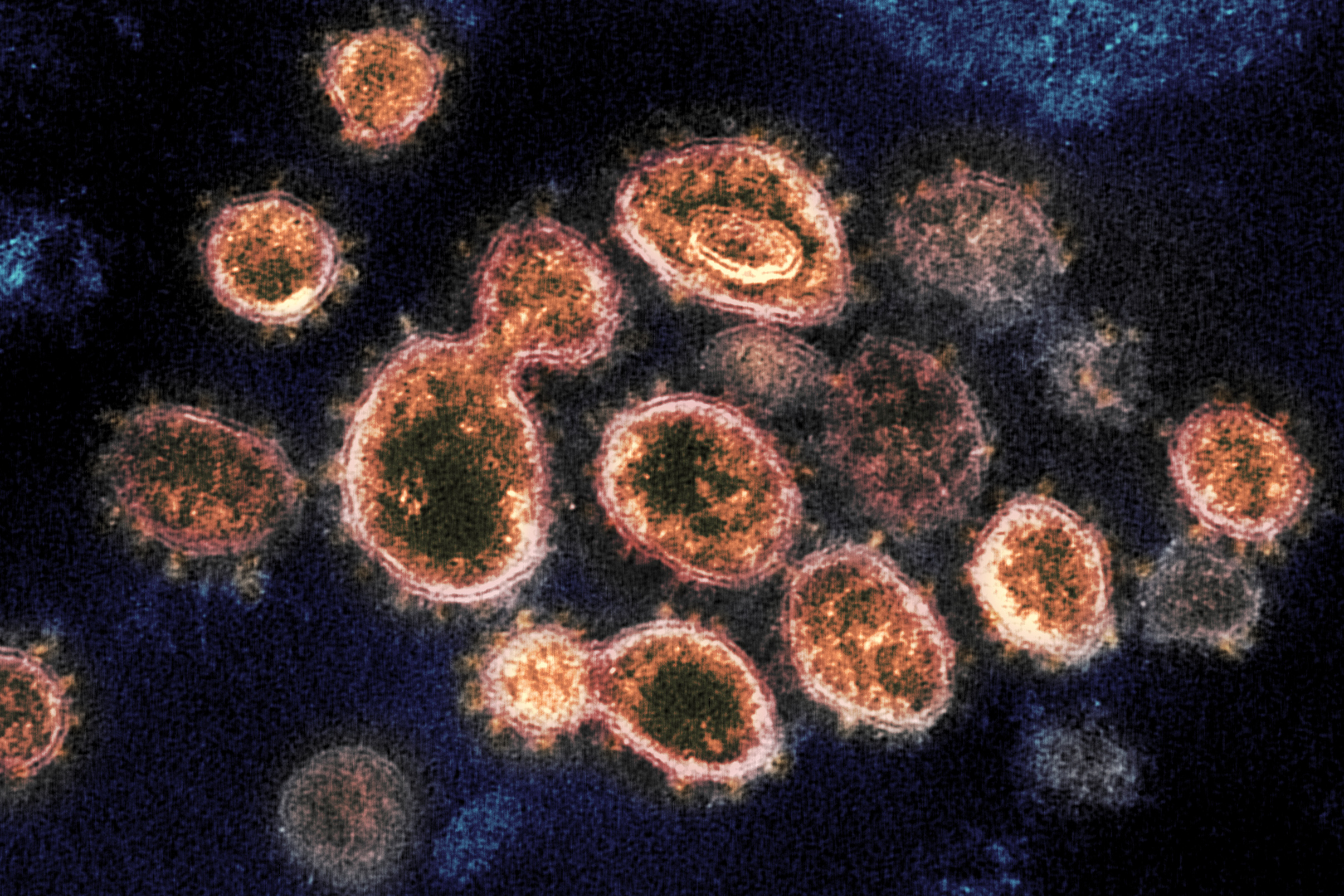 COVID-19-Coronavirus-microscope