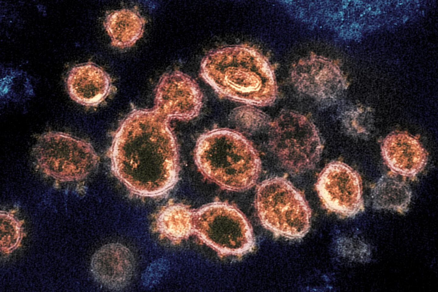 COVID-19-Coronavirus-microscope