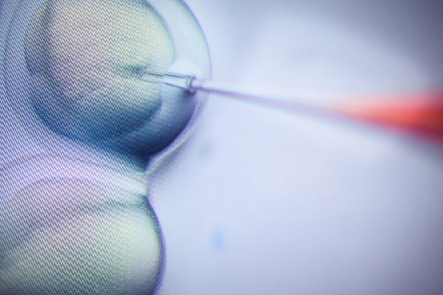 CRISPR blindness trial