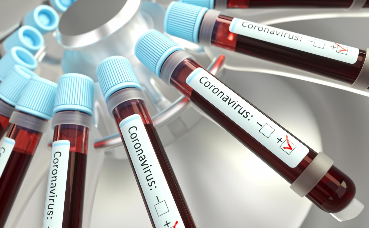 Coronavirus fake treatments
