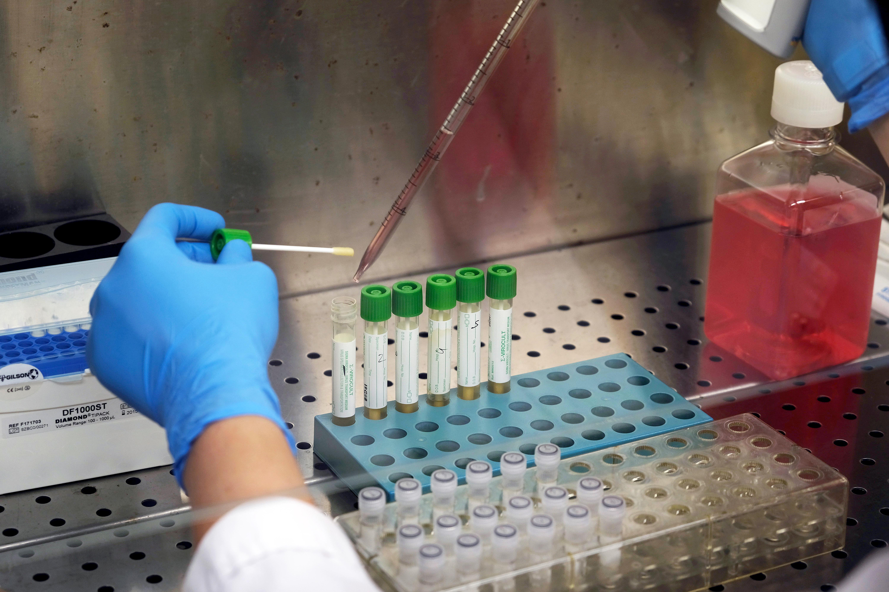 Coronavirus doctor says patients with high blood pressure