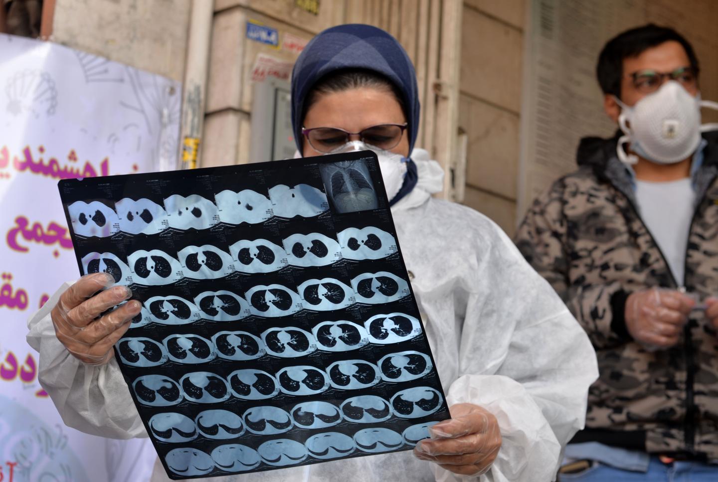 Symptoms of coronavirus moving to lung from nose and throat can happen very quickly