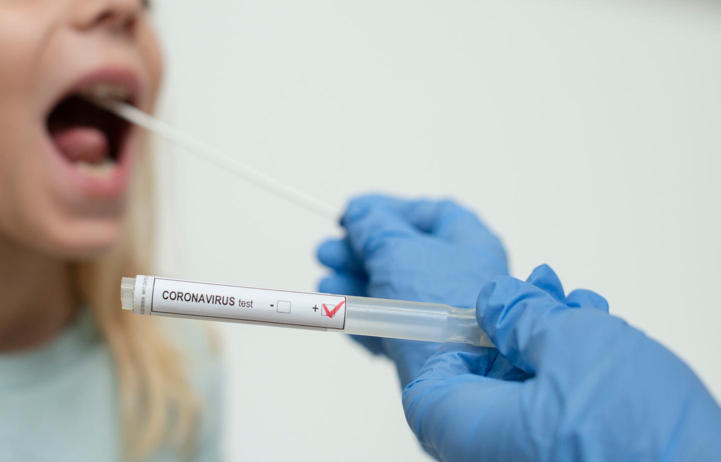 Silicon Valley VC firm offers to expedite coronavirus tests to its investors