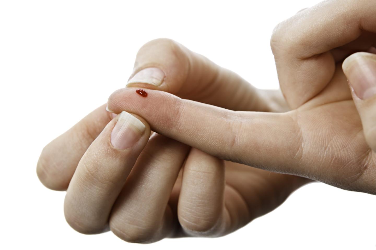 Henry Schein says its coronavirus test takes just 15 minutes, and there’s no swab necessary