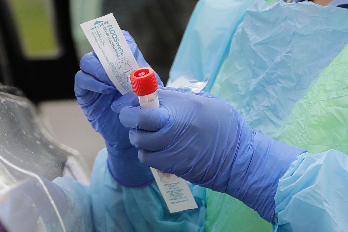 A federal report due out April 6 finds that three out of four U.S. hospitals surveyed are already treating patients with confirmed or suspected COVID-19.