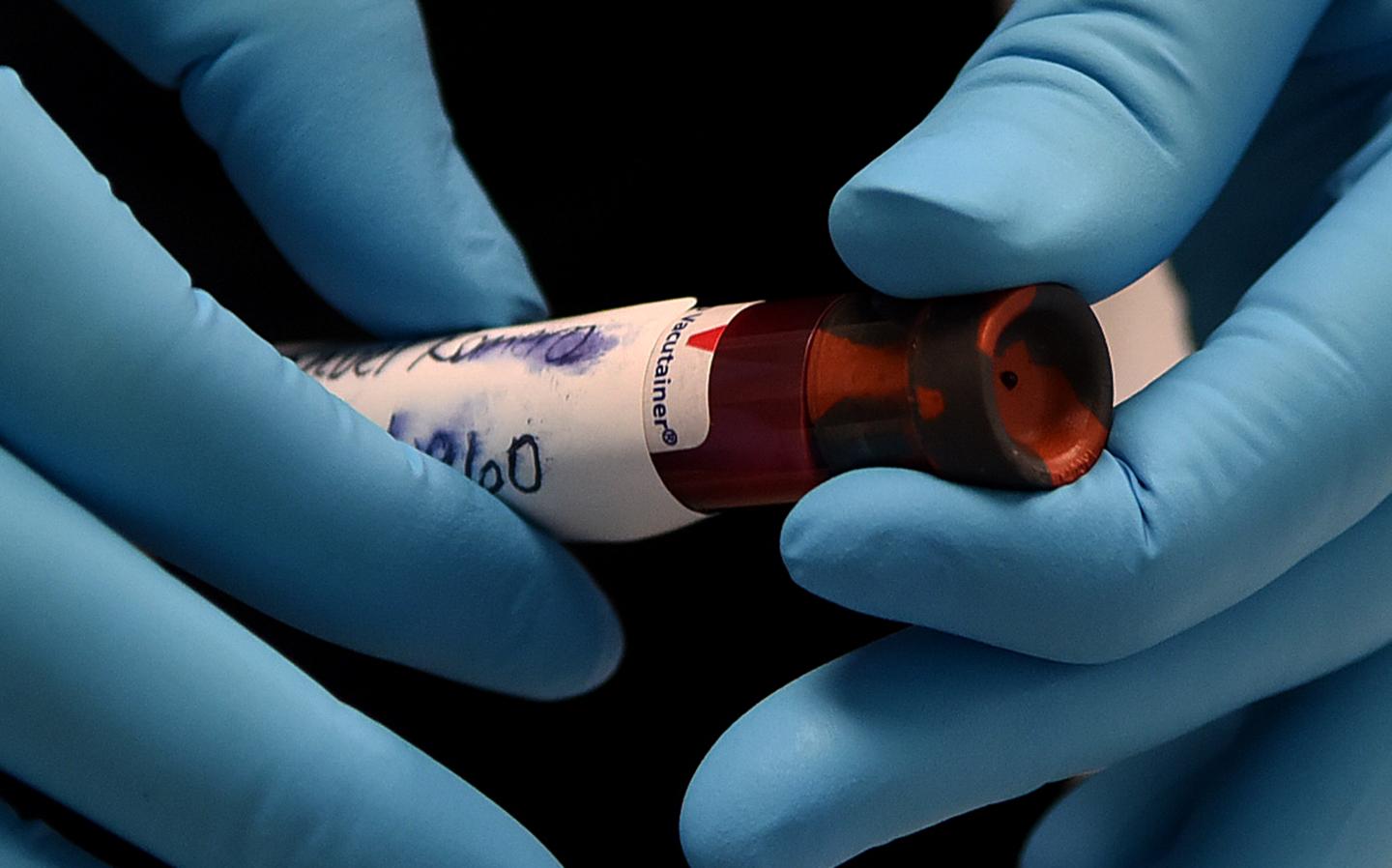 Antibody testing will be key—once we understand what the results mean