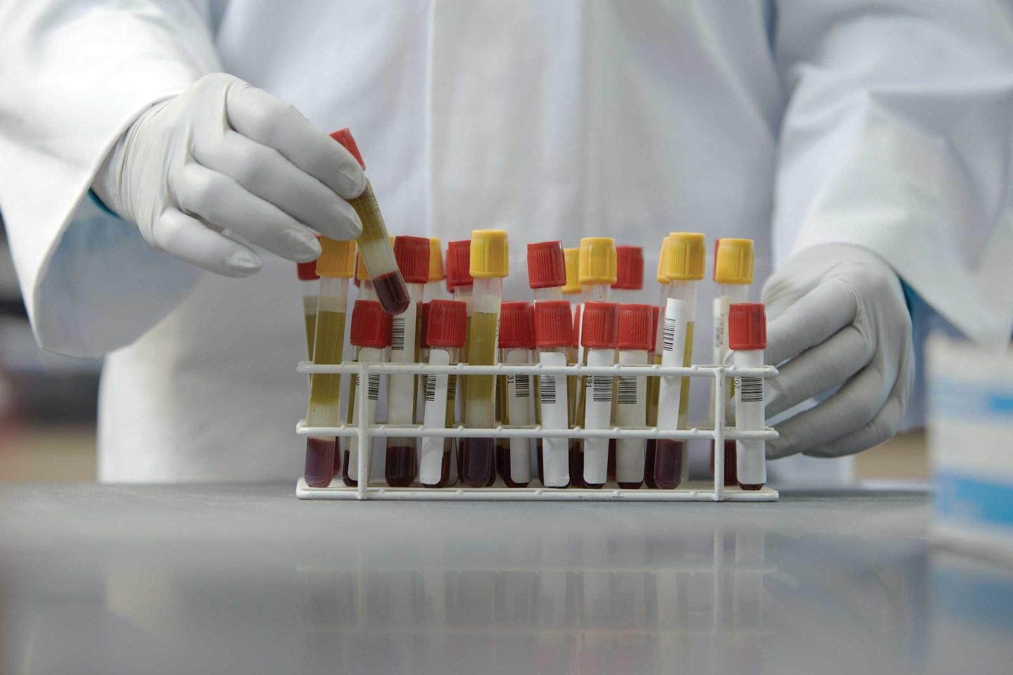 How a company that makes COVID tests is keeping its own 50,000 employees safe