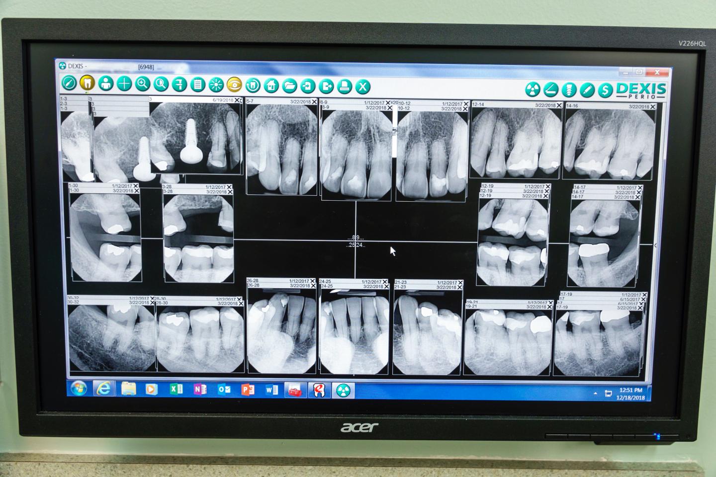 Teledentistry is filling a cavity left by the pandemic, but some caution it can’t replace in-person visits