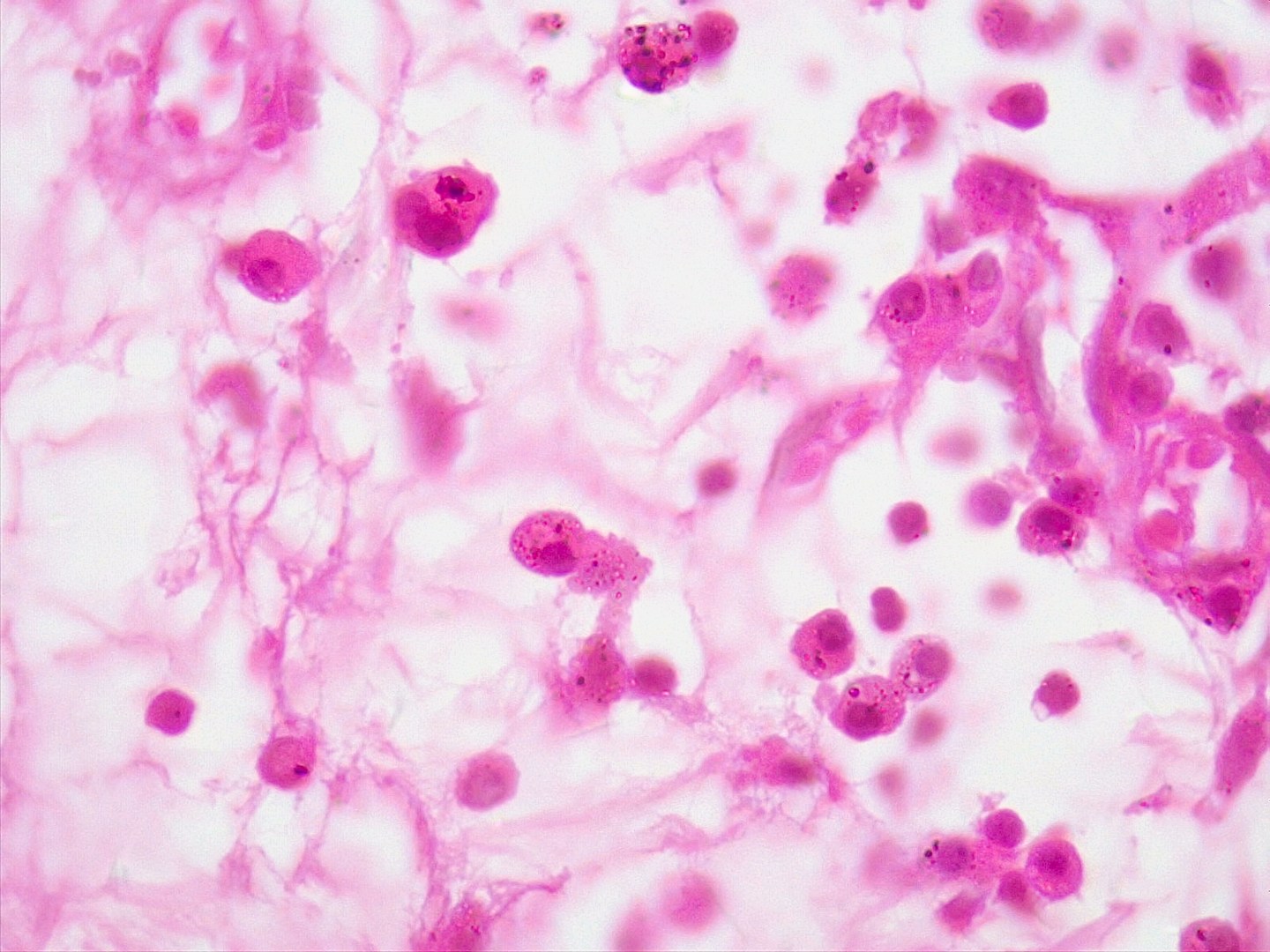 While we wait for COVID-19 vaccines, convalescent plasma therapy could be a treatment that keeps our economy afloat, writes David Sullivan.