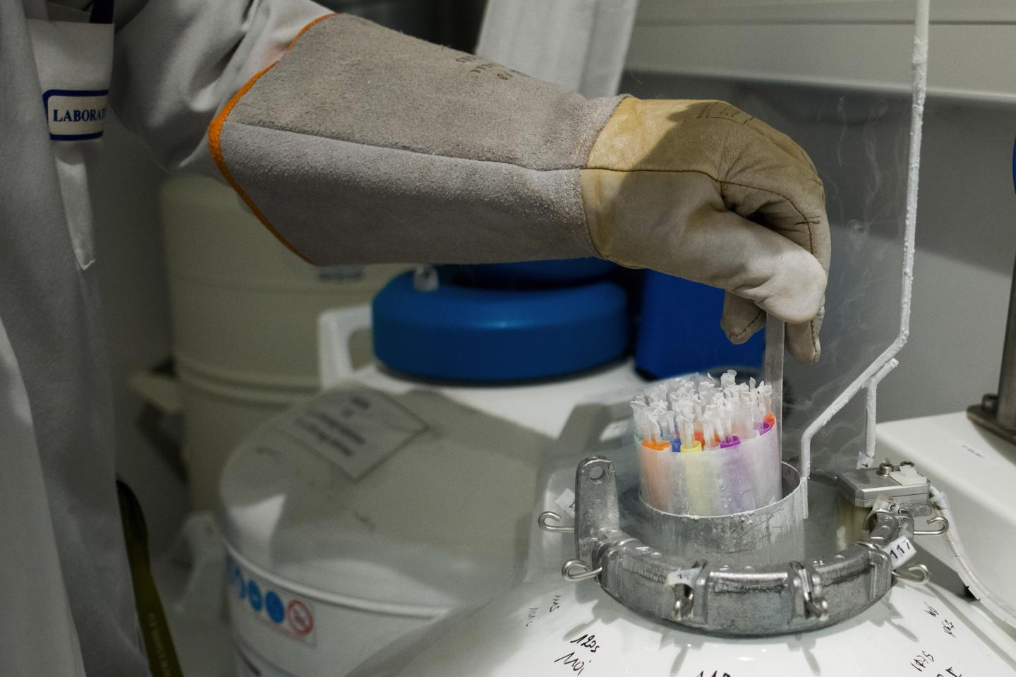 Pfizer’s COVID vaccine comes with a chilly complication. But that may change