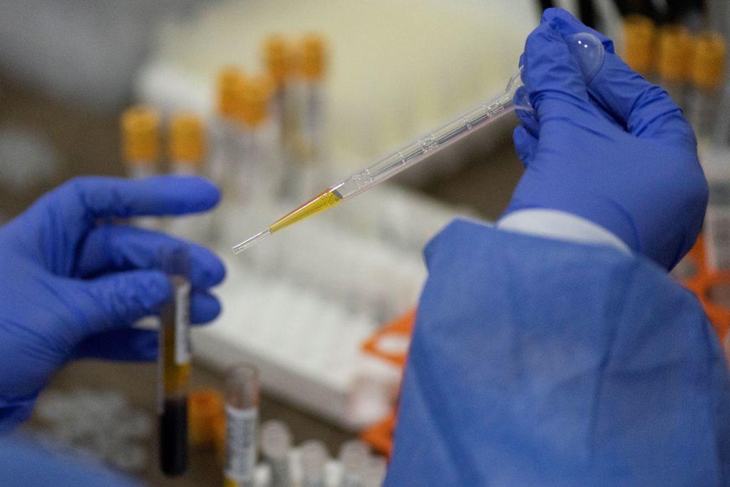 J&J says efficacy of one-shot COVID-19 vaccine could beat expectations