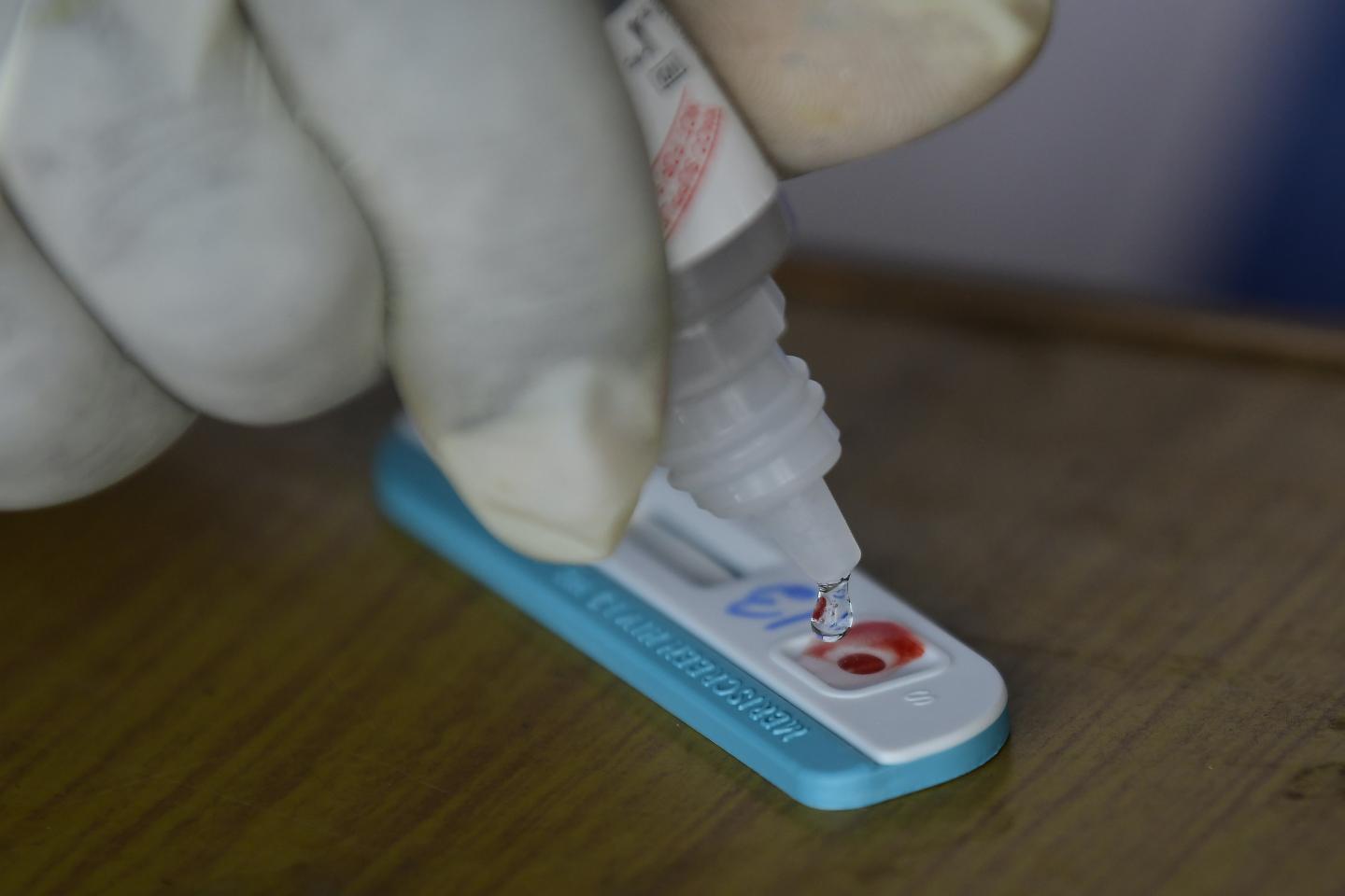 Health experts fear rise in HIV infections as COVID halted progress on treatment, prevention