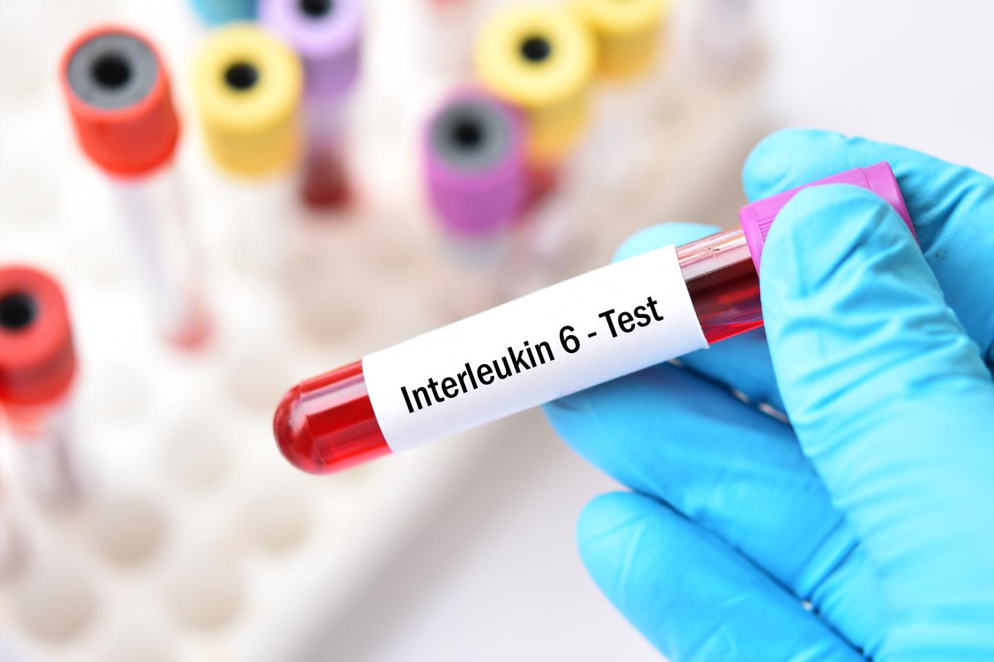 WHO: Drug that blocks immune system overload reduces COVID-19 deaths