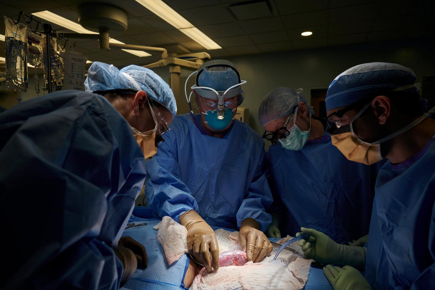 Scientists successfully attach a pig’s kidney to a human body in quest to use animal organs for transplants