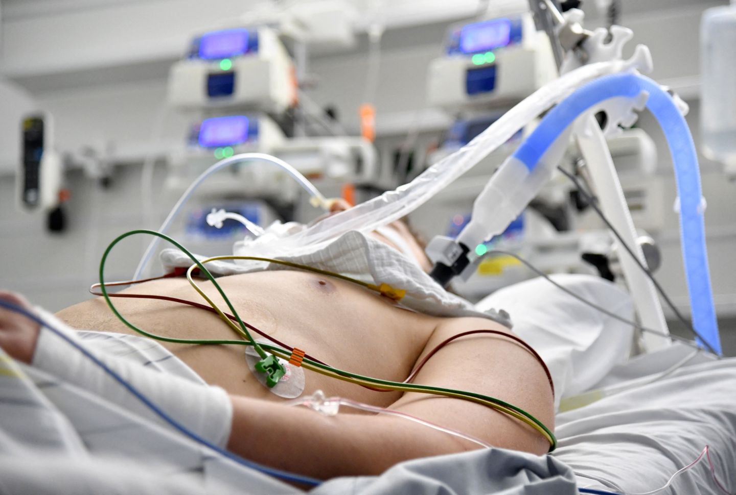 A patient lies in an intensive care unit at a hospital of the Salzburg state clinics in Salzburg, Austria, on Nov. 17, 2021.