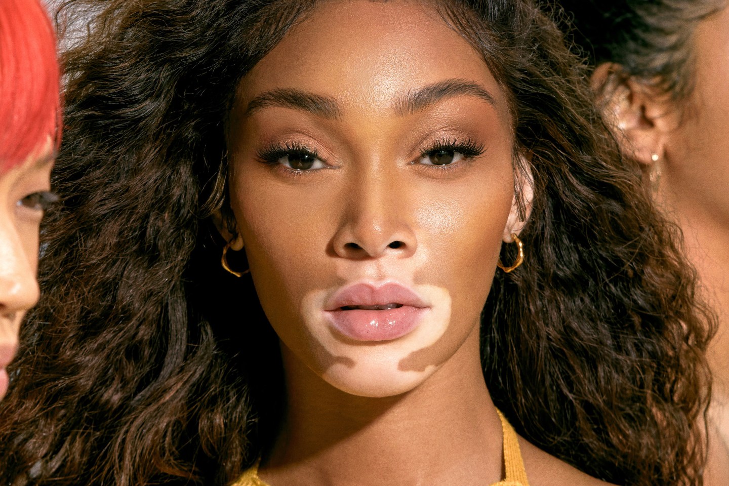 Model Winnie Harlow raises $6 million for sunscreen brand for Black skin
