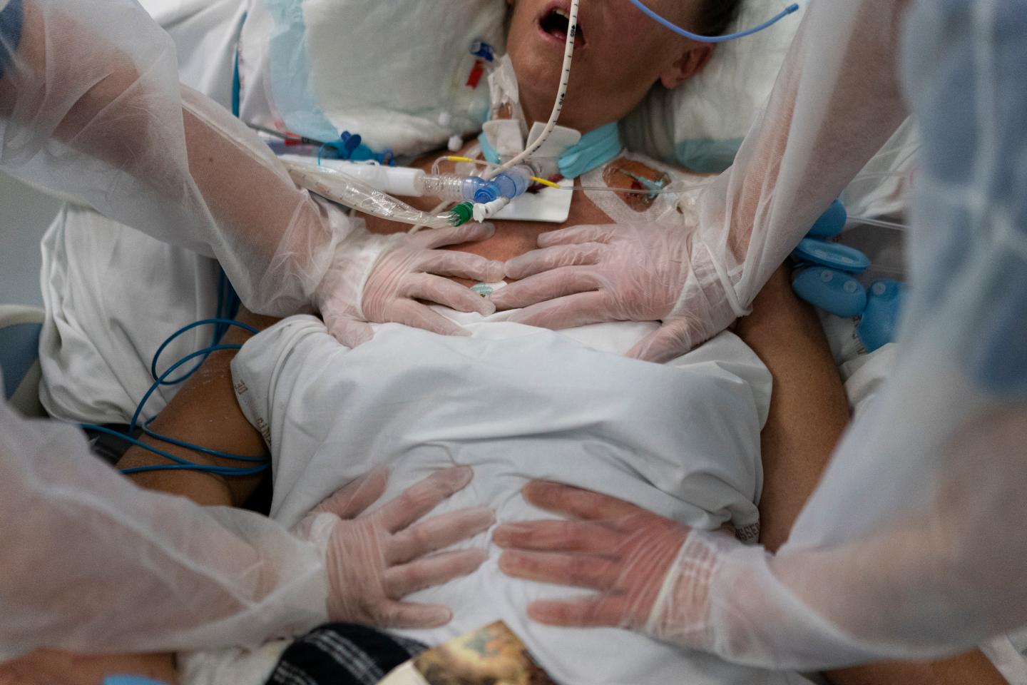 Nurses perform timed breathing exercises on a COVID-19 patient on a ventilator in the COVID-19 intensive care unit at the la Timone hospital in Marseille, southern France, Friday, Dec. 31, 2021. The official global death toll from COVID-19 is on the verge of eclipsing 6 million — underscoring that the pandemic, now in its third year, is far from over.