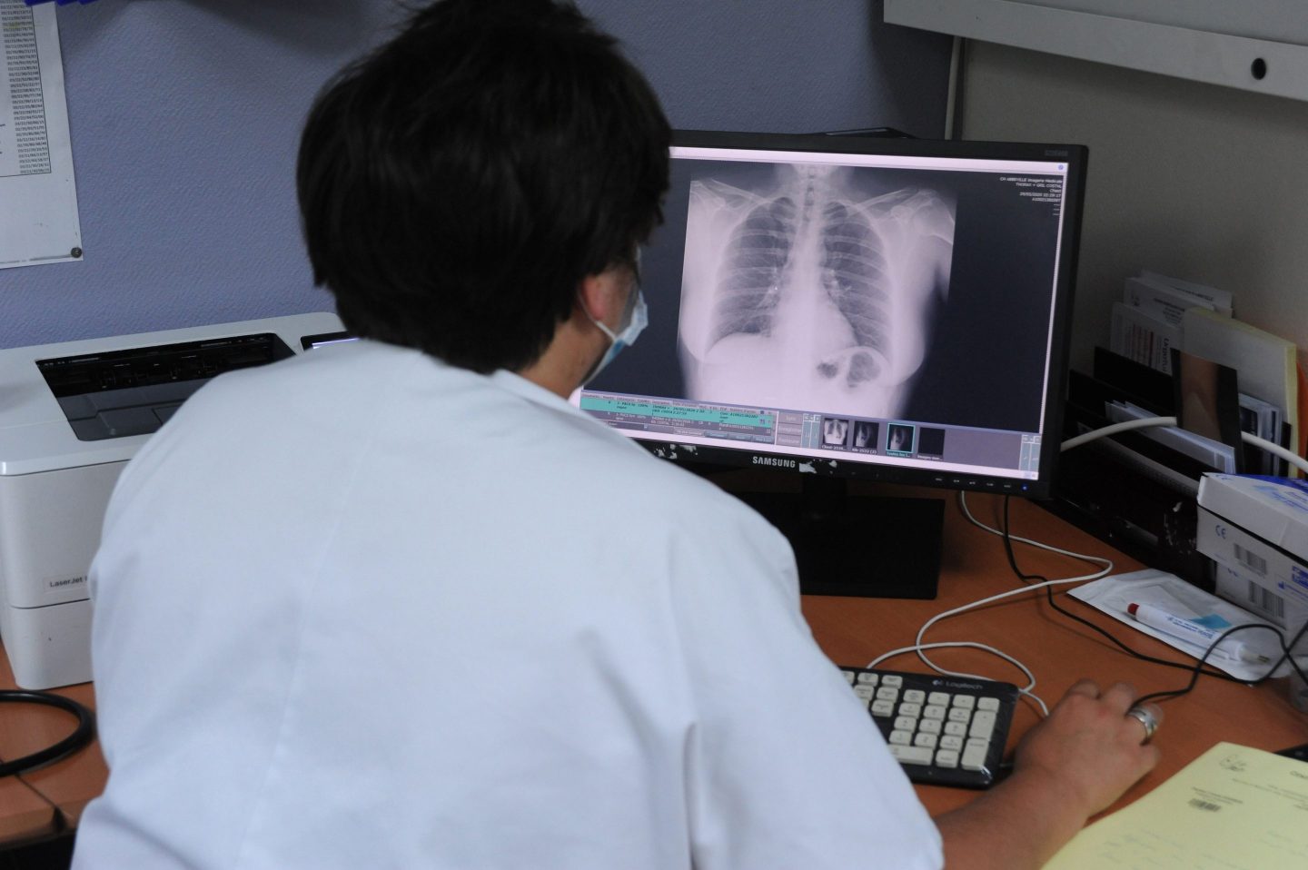 A radiologist scrutinizes a digital X-ray of a patient's chest on a computer monitor.