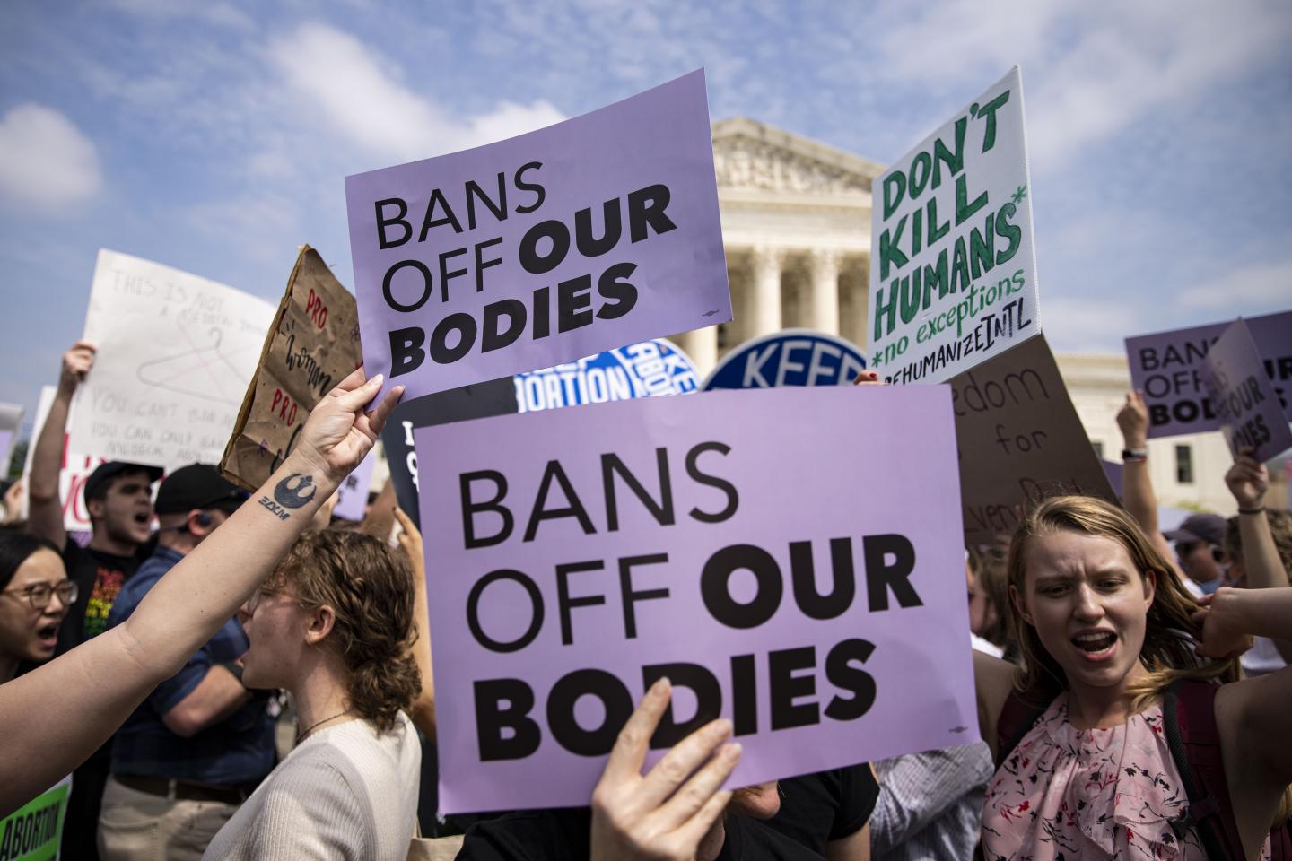 The end of Roe v. Wade is a workforce issue. Businesses can’t avoid talking about abortion anymore