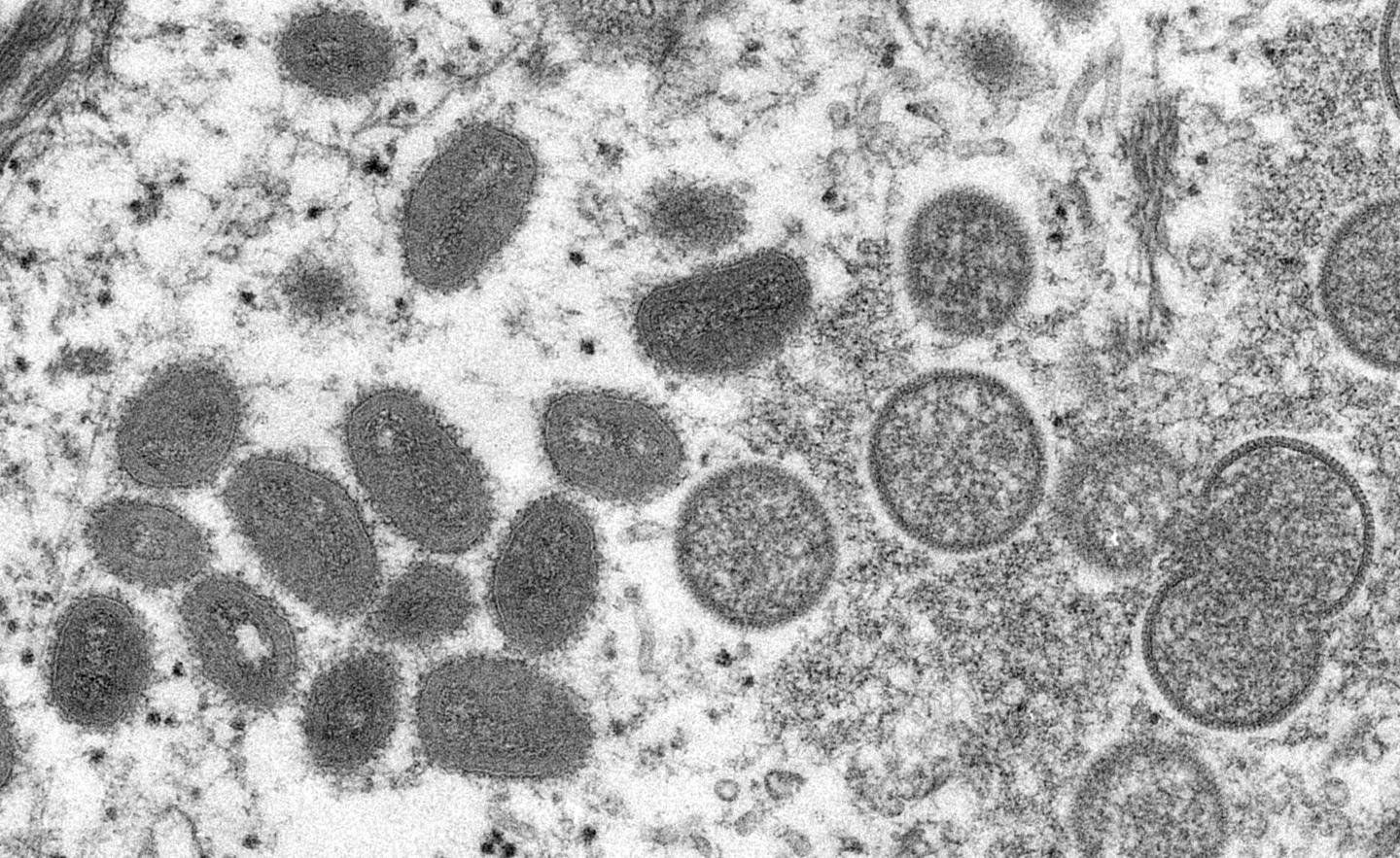 How a Chinese nationalist influencer is stoking conspiracy theories over U.S. spreading monkeypox