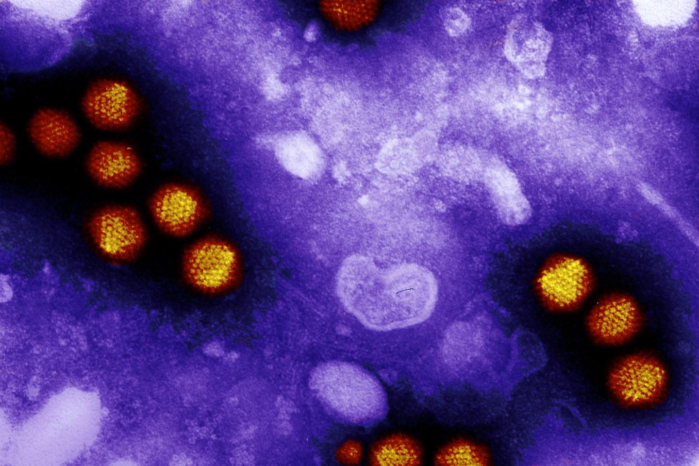 CDC to investigate whether adenovirus is ‘incidental’ in children with mysterious hepatitis