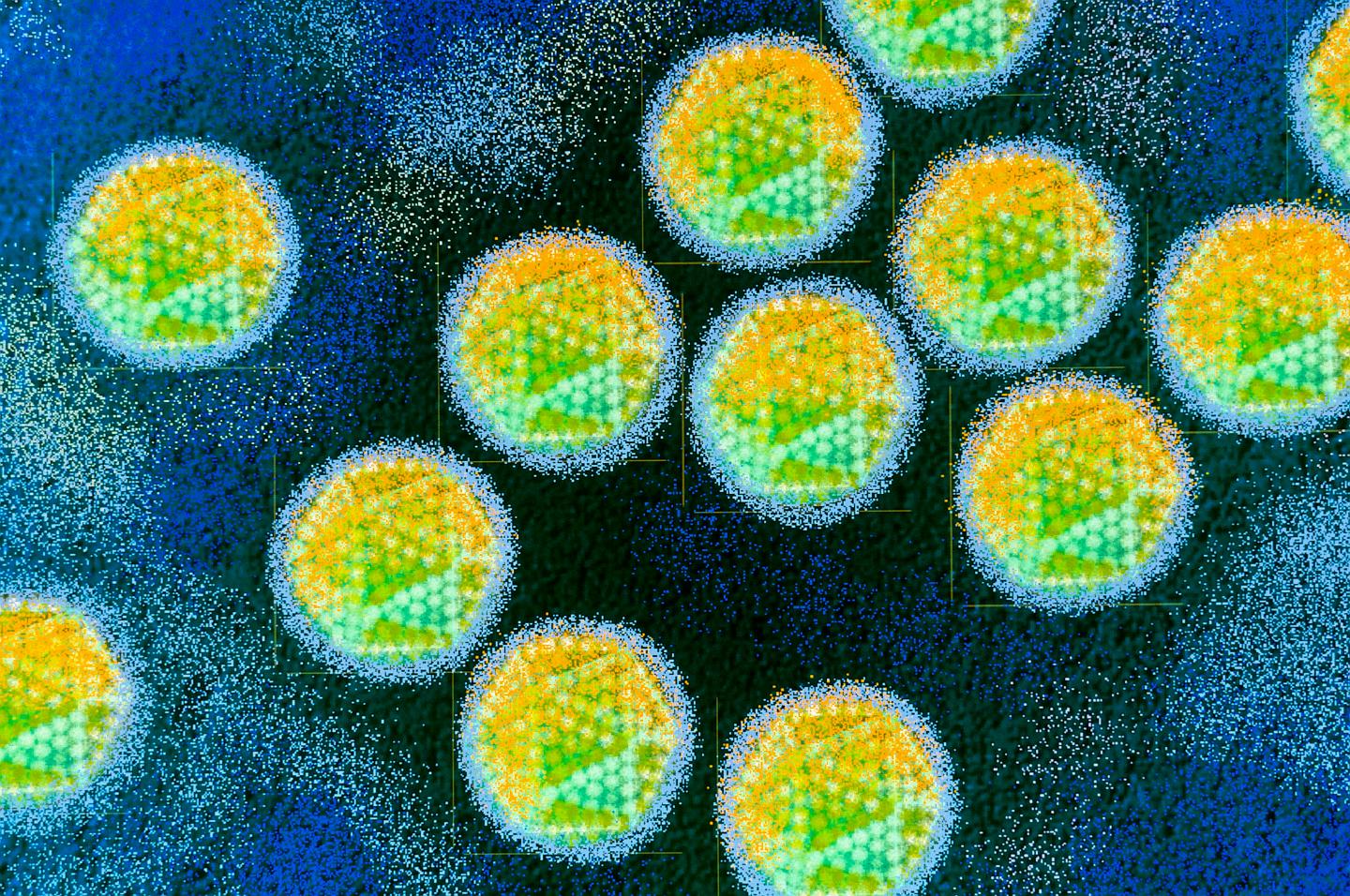 Adenovirus? COVID? Dogs? What’s behind the outbreak of hepatitis in children?