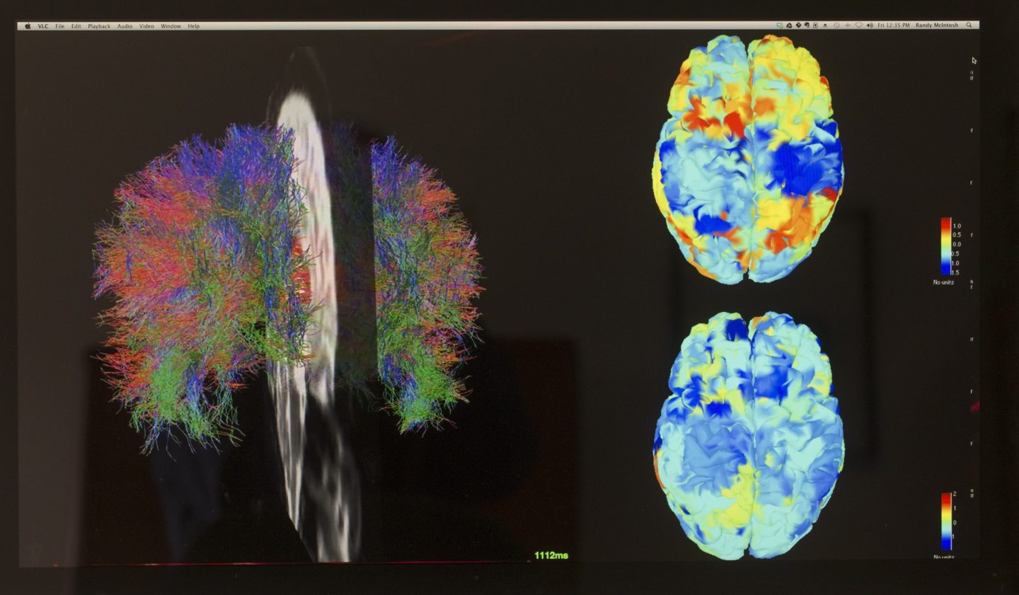 Images from a brain scan using functional MRI.