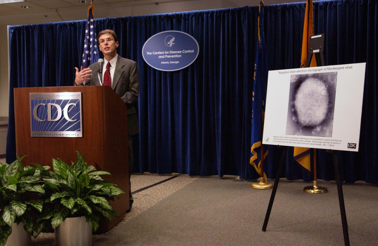 First monkeypox case in U.S. this year identified; 6 people in U.S. being monitored by health officials for potential exposure, CDC says