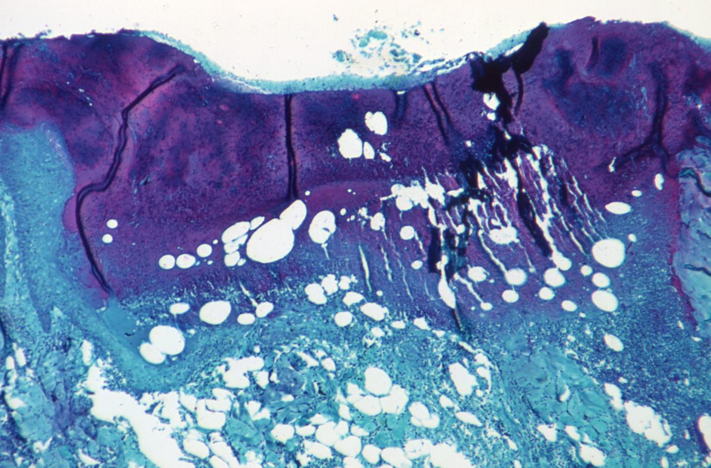 ‘Archaic tools that just don’t help us get the job done’: Doctors warn a lack of reporting infrastructure makes the U.S. vulnerable to the next outbreak