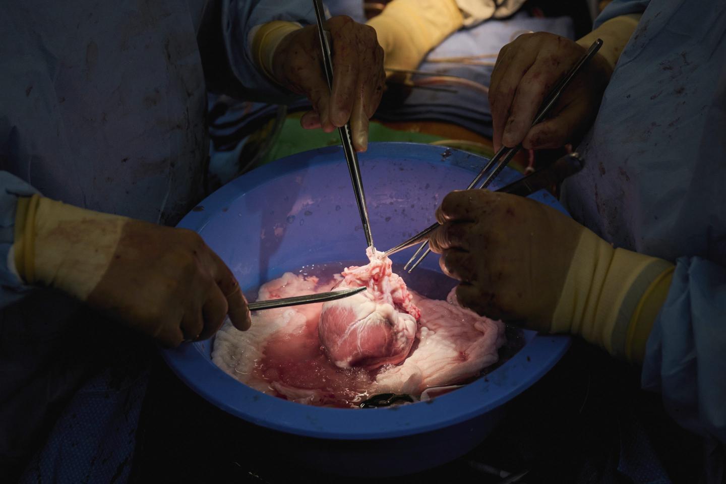 Pig-human heart transplants
