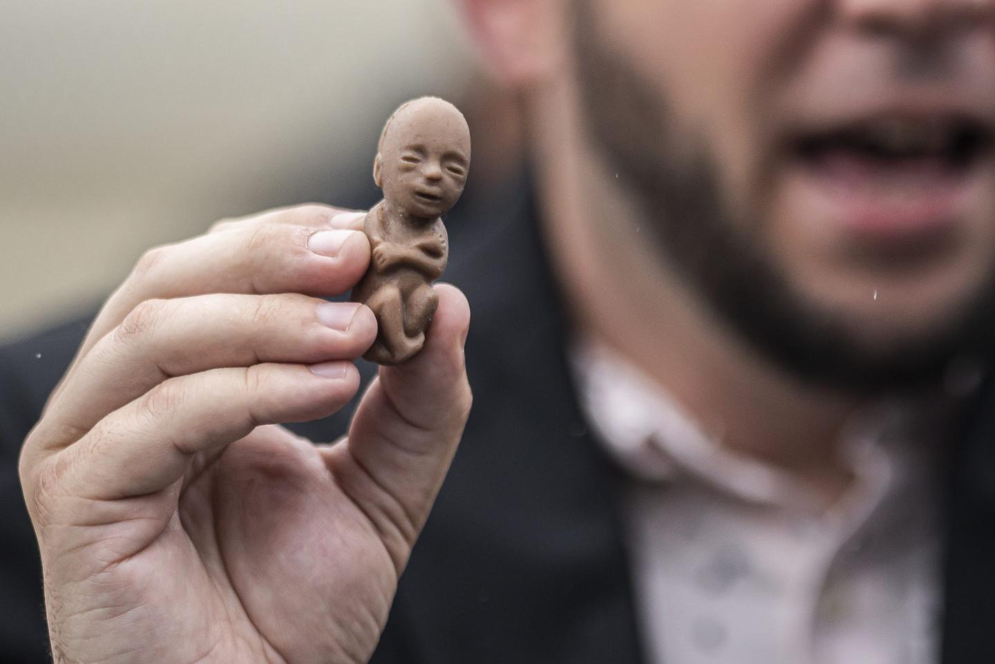 An anti-abortion activist holds a plastic fetus