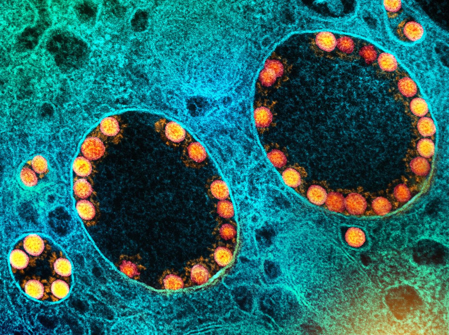 The rise of a new ‘Deltacron’? BA.5 combines the worst traits of Omicron with the potential for severity reminiscent of Delta, experts say
