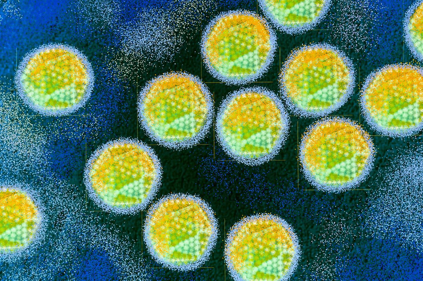Mystery of global uptick in hepatitis affecting children may have been solved
