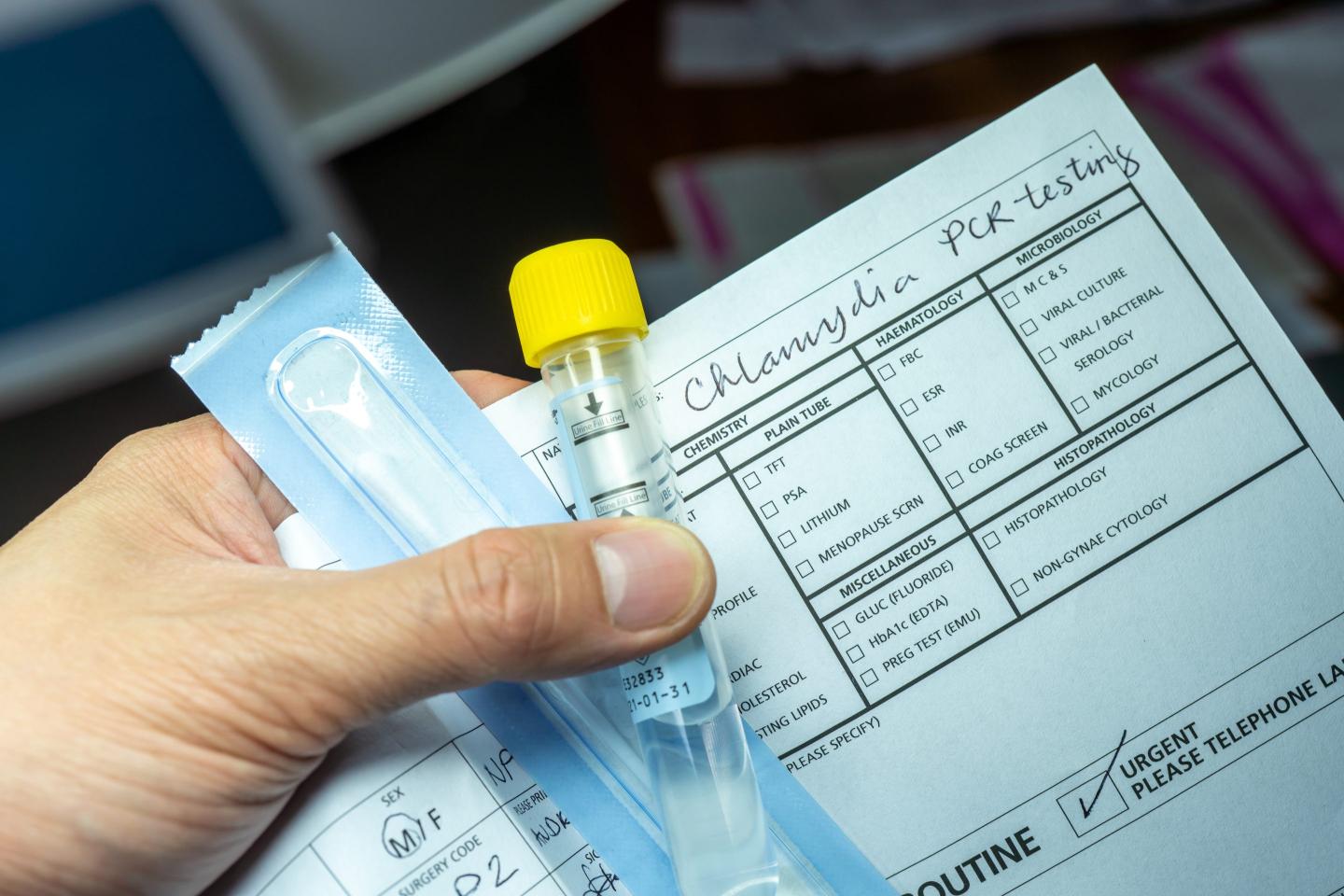 A sample collection tube for chlamydia