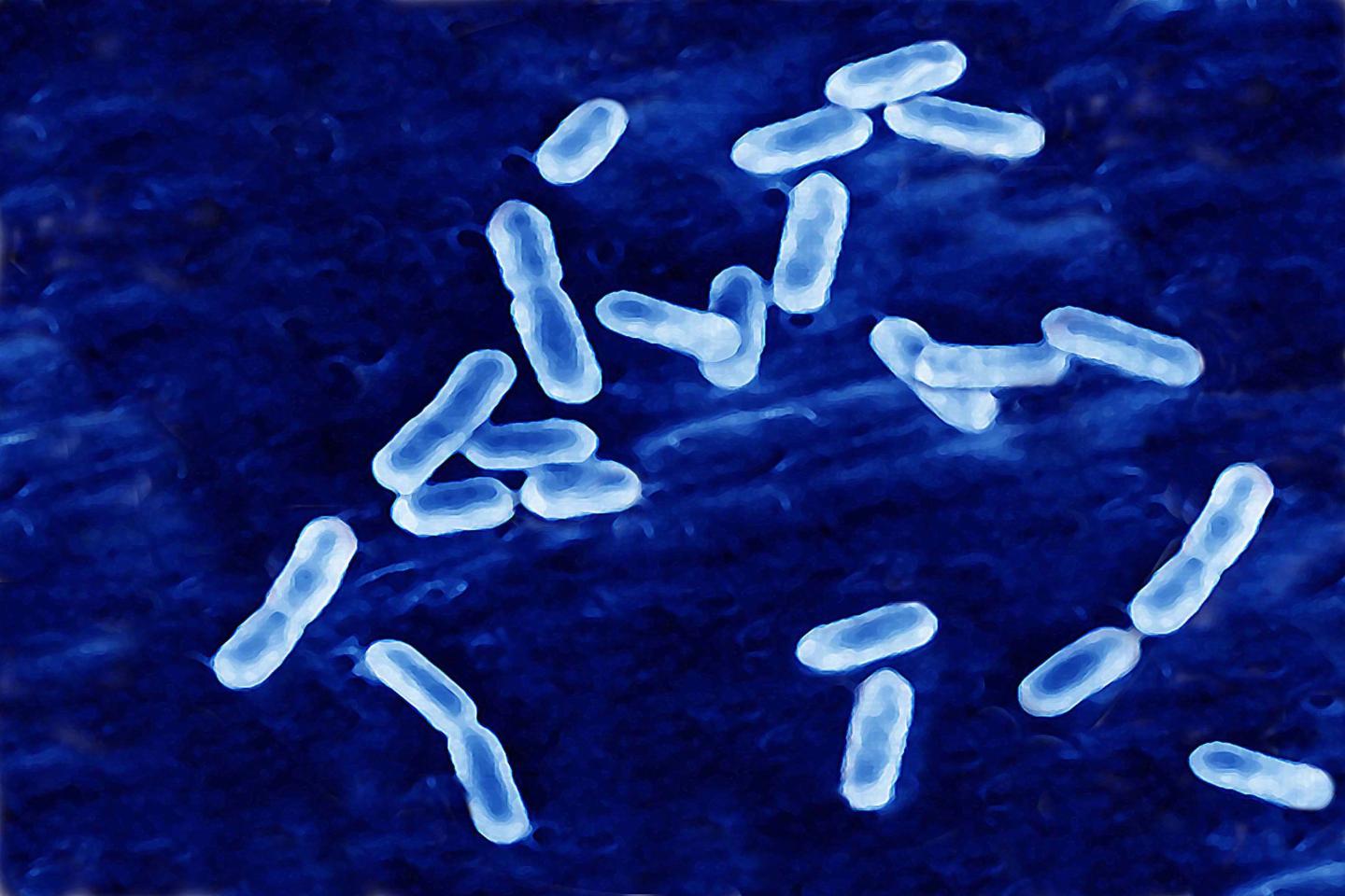 Gram positive bacilli that causes listeriosis as seen under an optical microscope X1000.