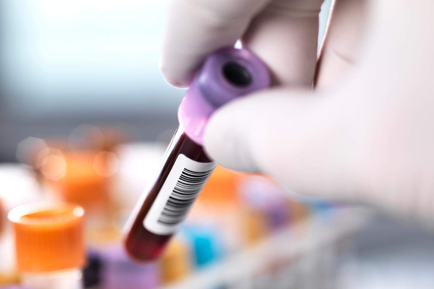 Researcher taking blood sample from a rack of medical samples.