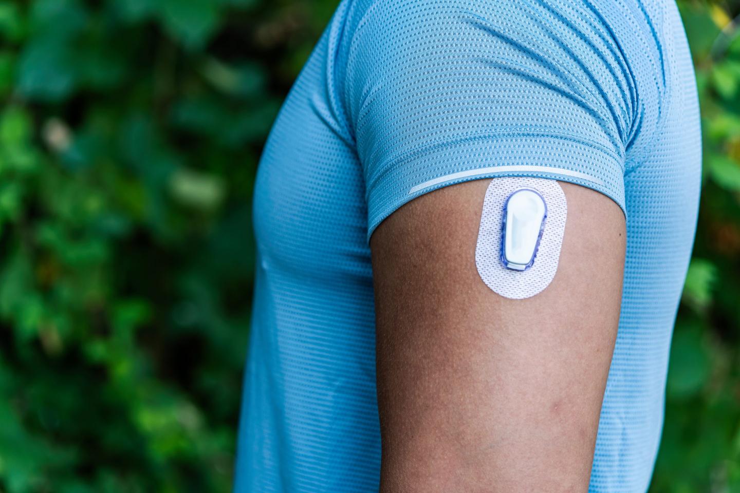 Continuous glucose monitors are trendy wearables—but how useful are they? Here’s what experts say