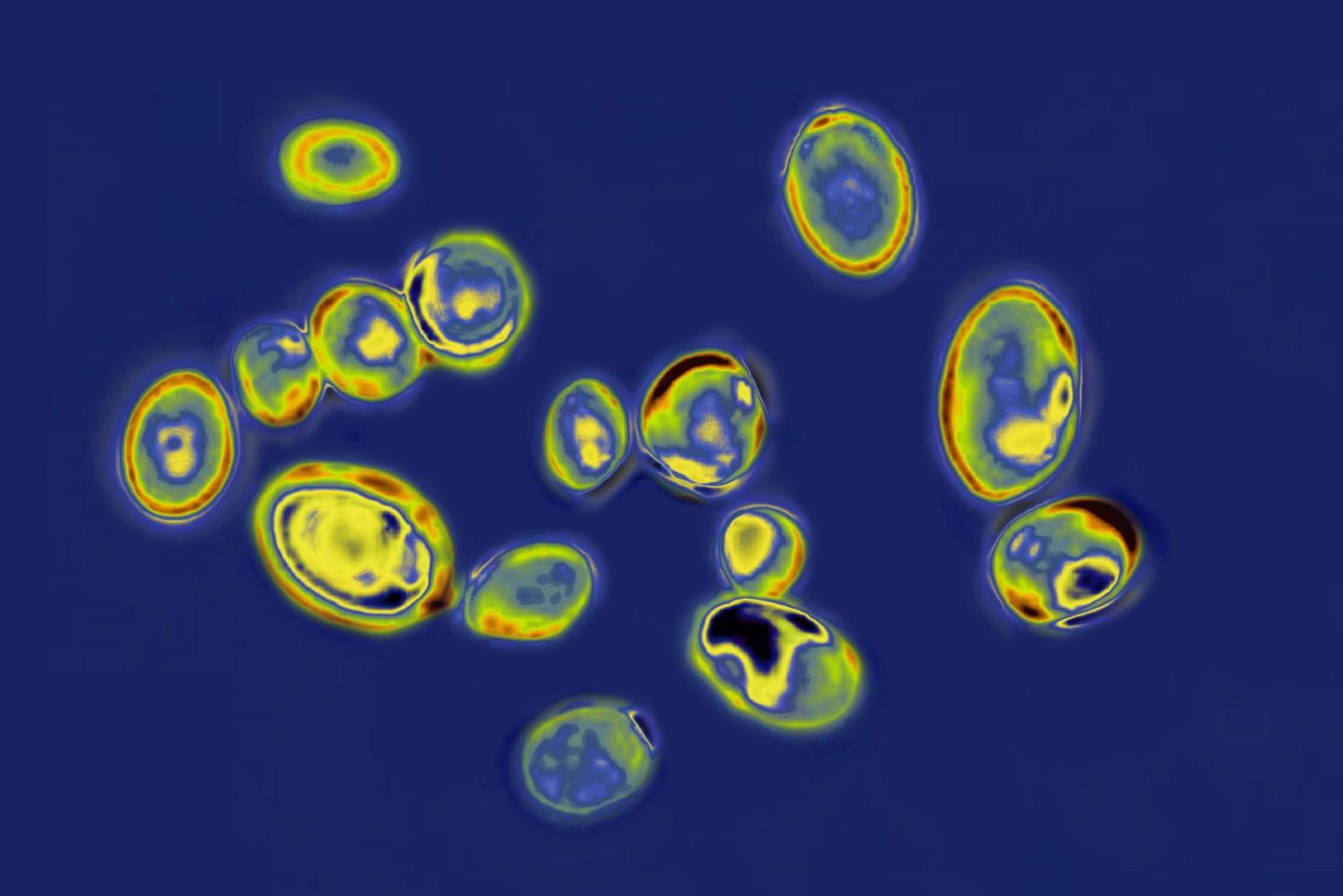 An optical microscope view of Candida auris.