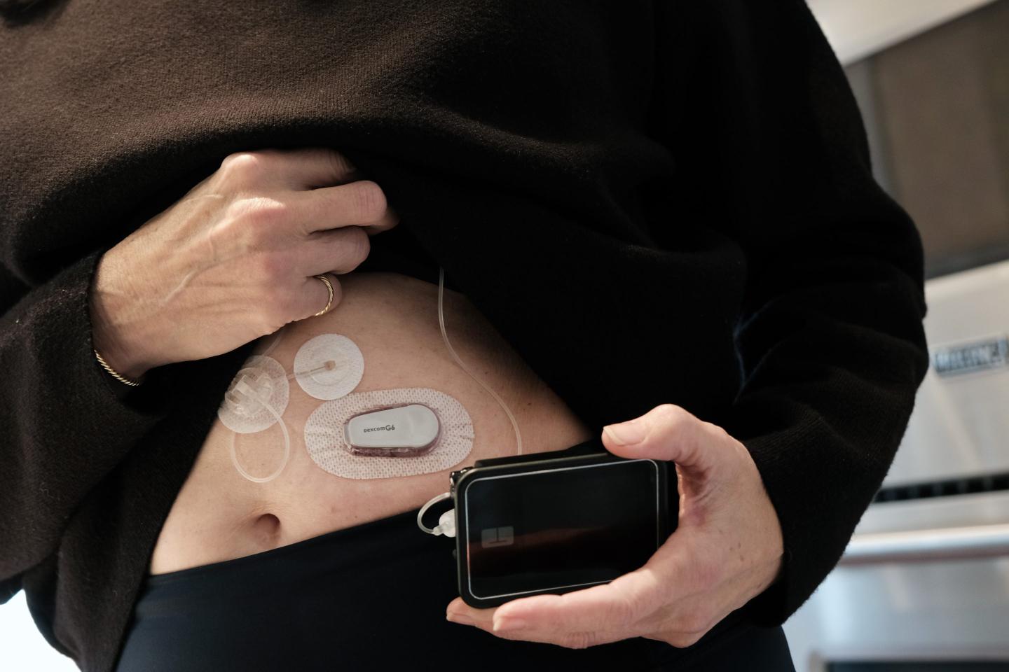 Powerful new obesity drug from Eli Lilly expected to be one of best selling drugs of all time, with sales over $50bn a year
