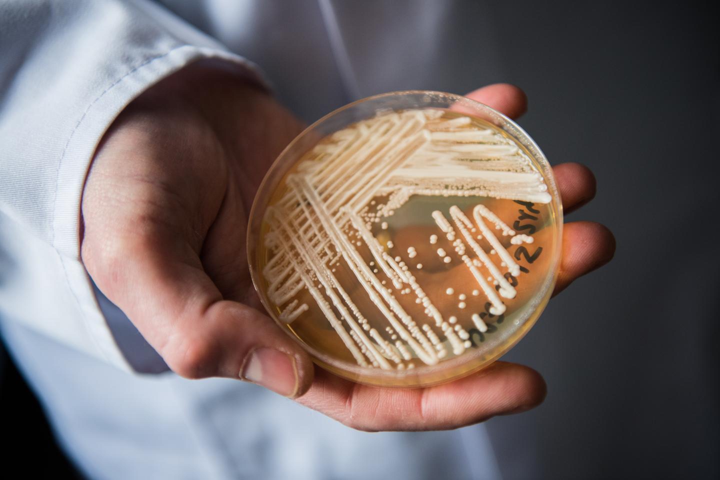 A deadly fungus is spreading across U.S. hospitals. Here’s what you need to know, according to a physician