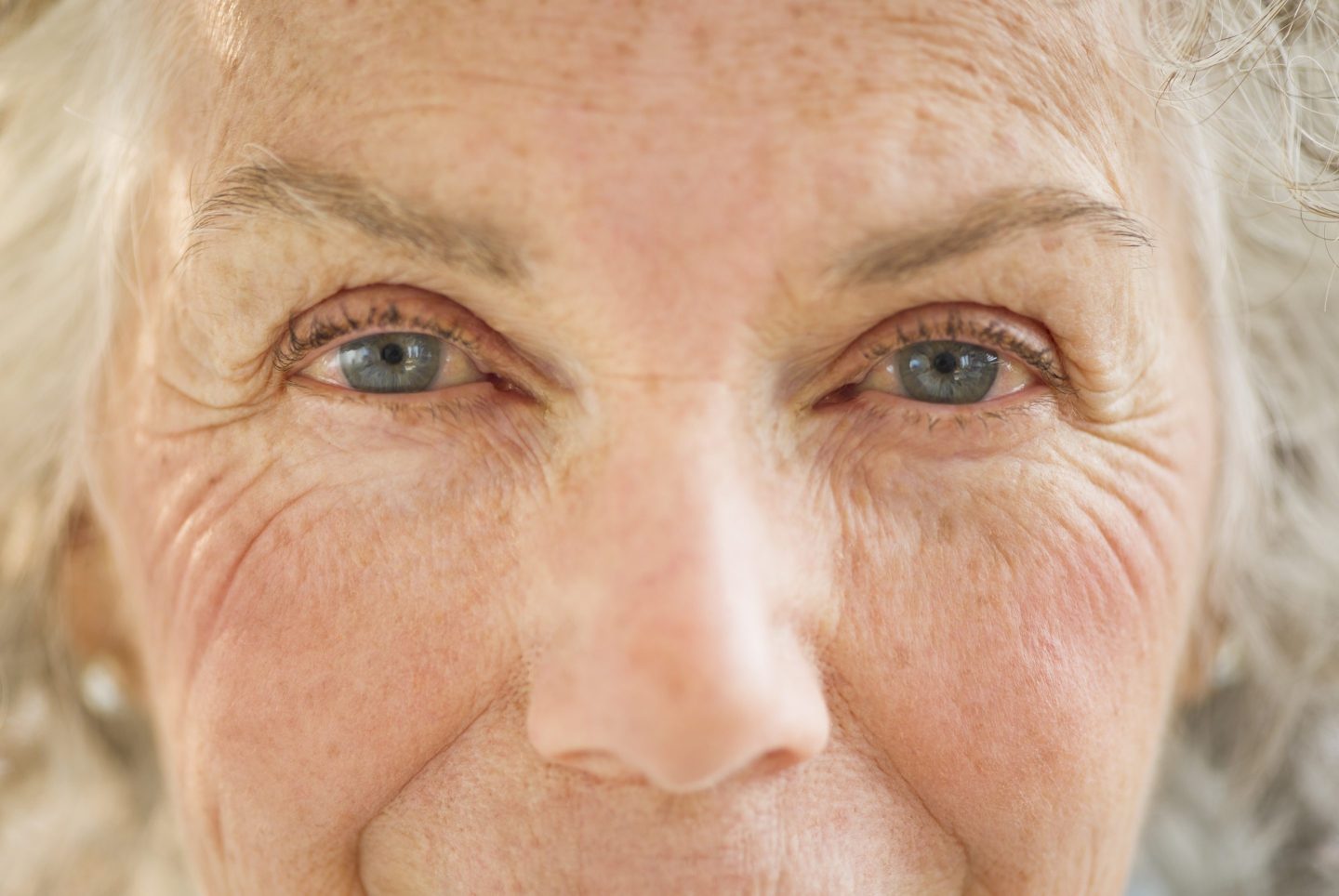 Cataract surgery often costs about $1,800 to $2,800.