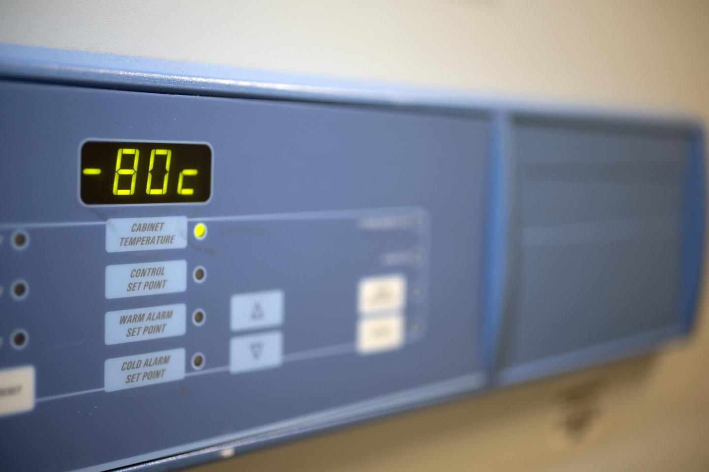 A freezer that kept specimens at minus 80 degrees Celsius was turned off, according to a lawsuit. 
