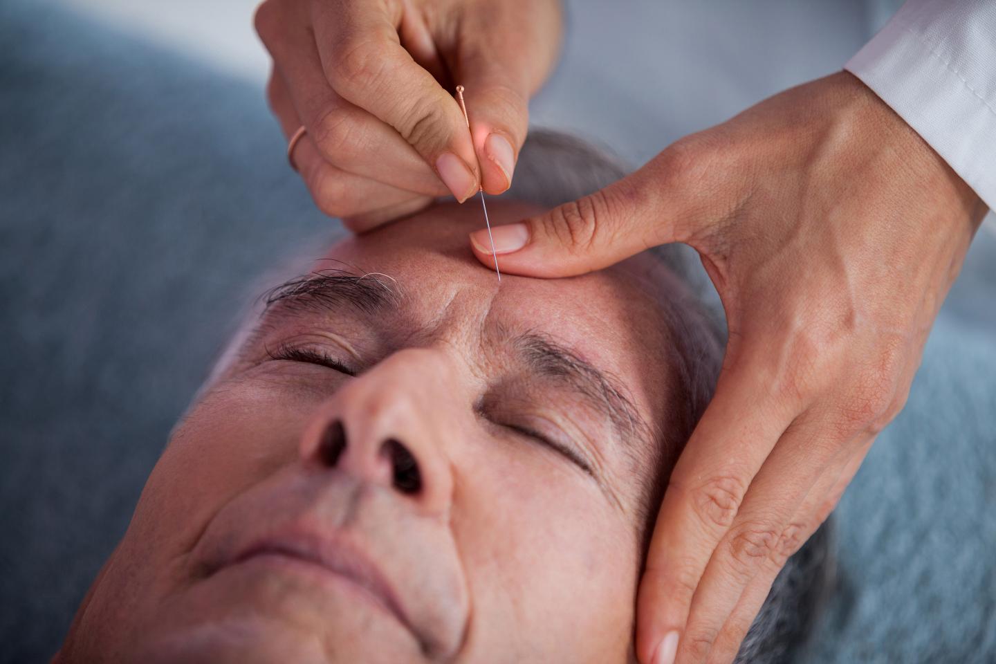 Does Medicare cover acupuncture? Only in some cases—but it may be difficult to find providers who meet the guidelines