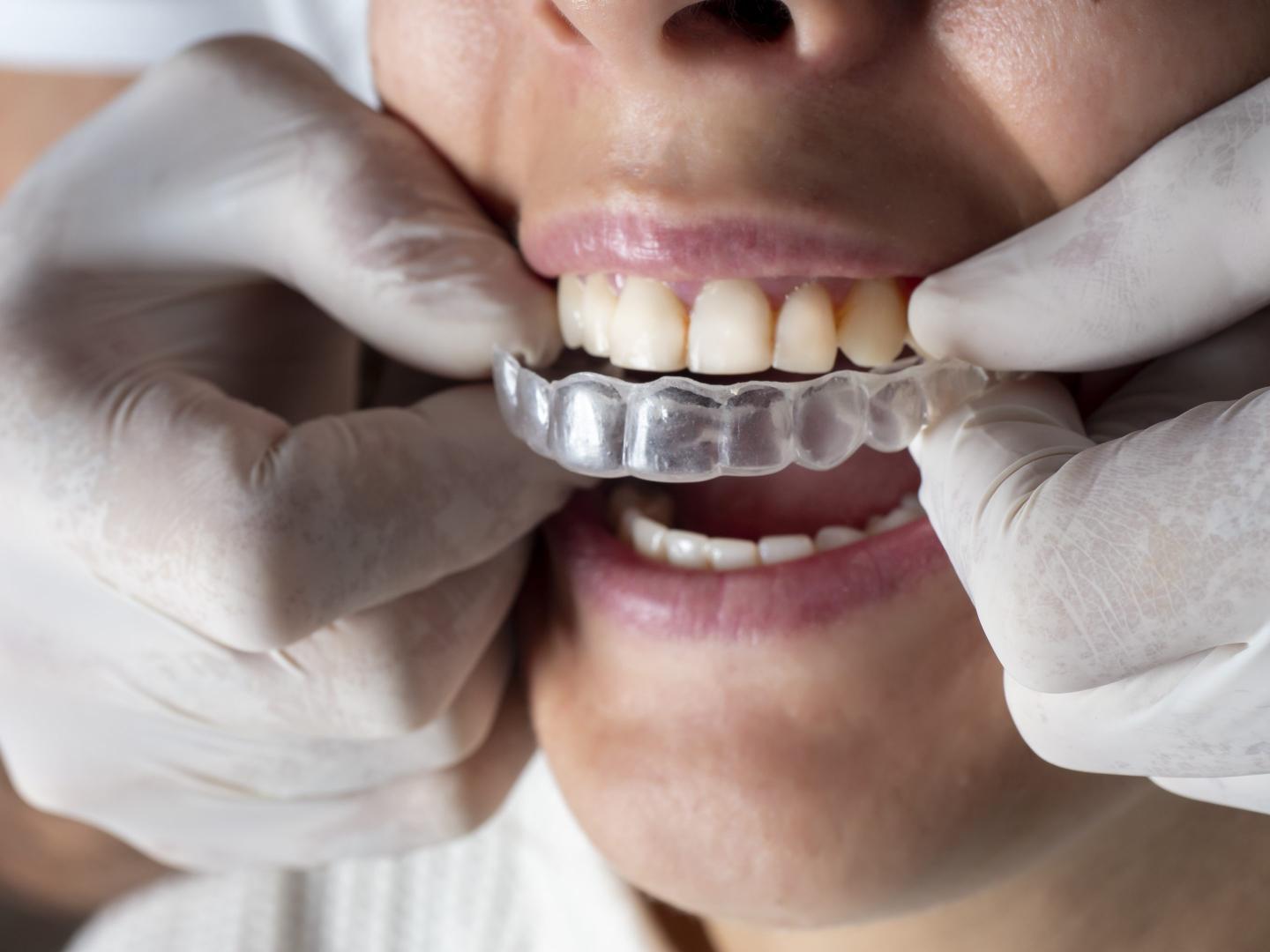 Once high-flying SmileDirectClub, the startup some derided as ‘DIY dentistry,’ is shutting down—here’s where that leaves its customers